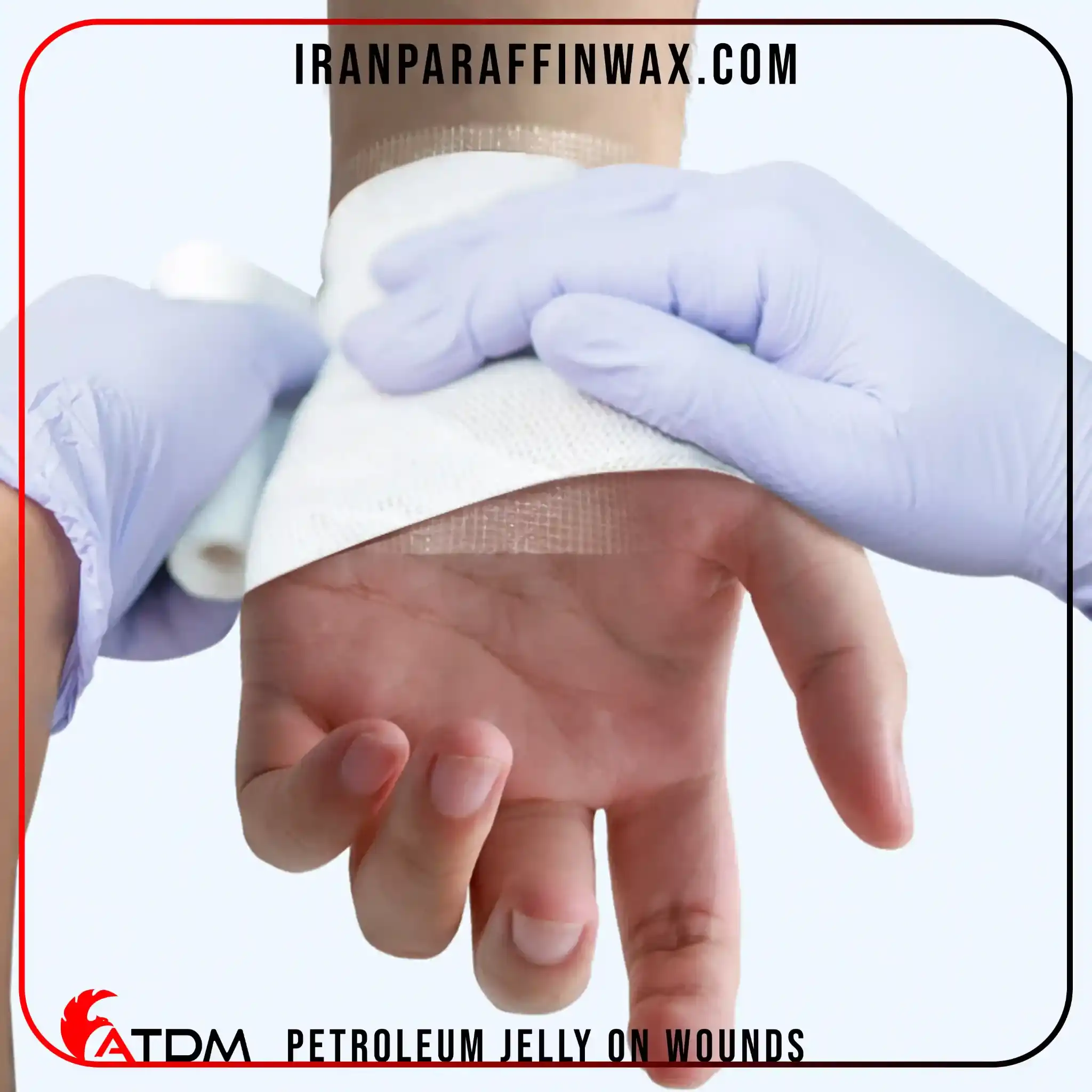 petroleum jelly on wounds